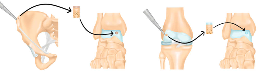 00f0eaa70c43499a87289e7698b923e1.png 00f0eaa70c43499a87289e7698b923e1.png