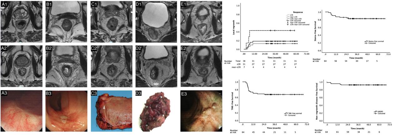 23205d147c924437bac7281b6ae52d23.jpg 23205d147c924437bac7281b6ae52d23.jpg